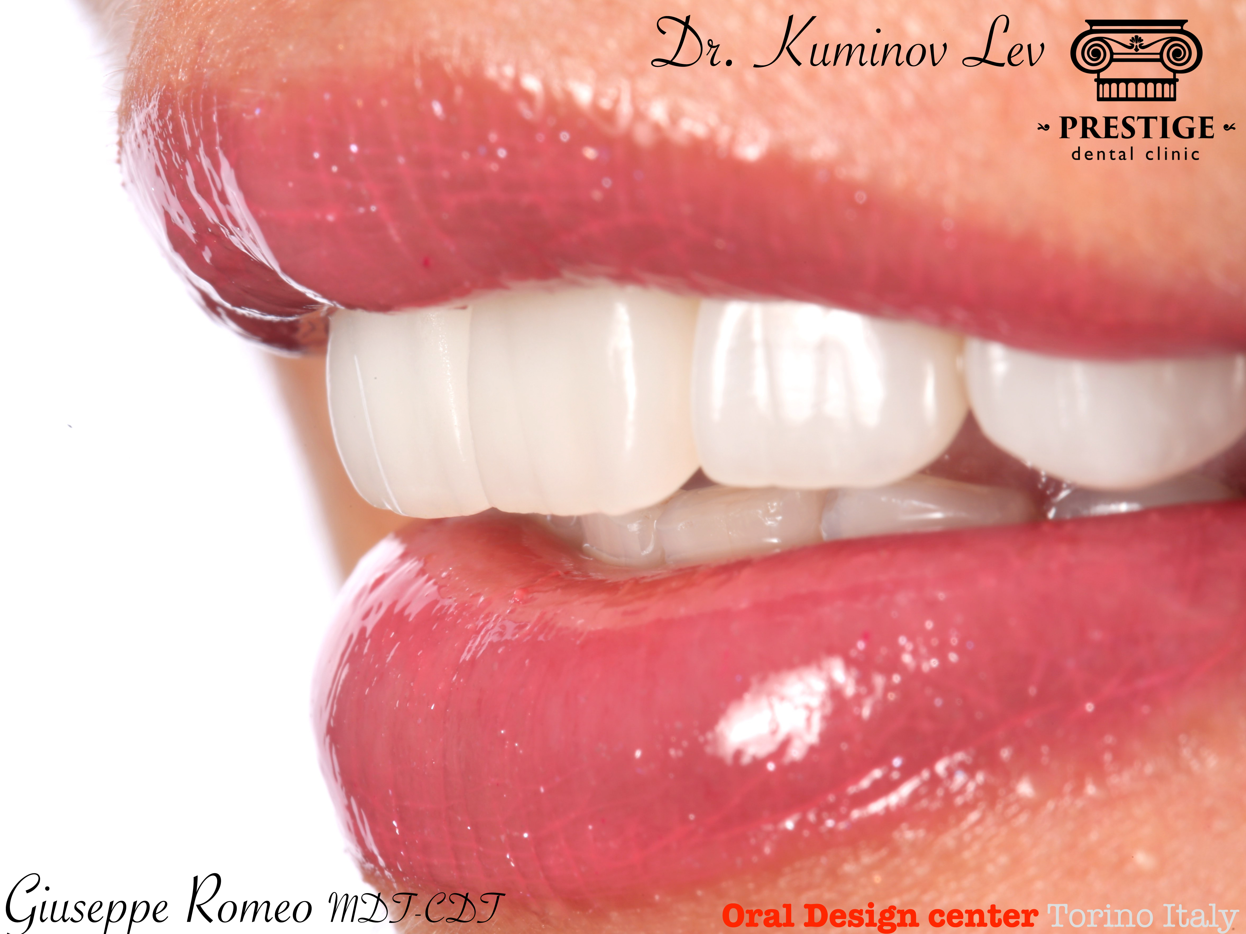Giuseppe Romeo в лаборатории "Oral design Italy ", г.Турин, Италия
